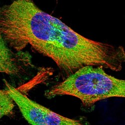 ZCCHV Antibody, Novus Biologicals 0.1mL; Unlabeled:Antibodies, Polyclonal